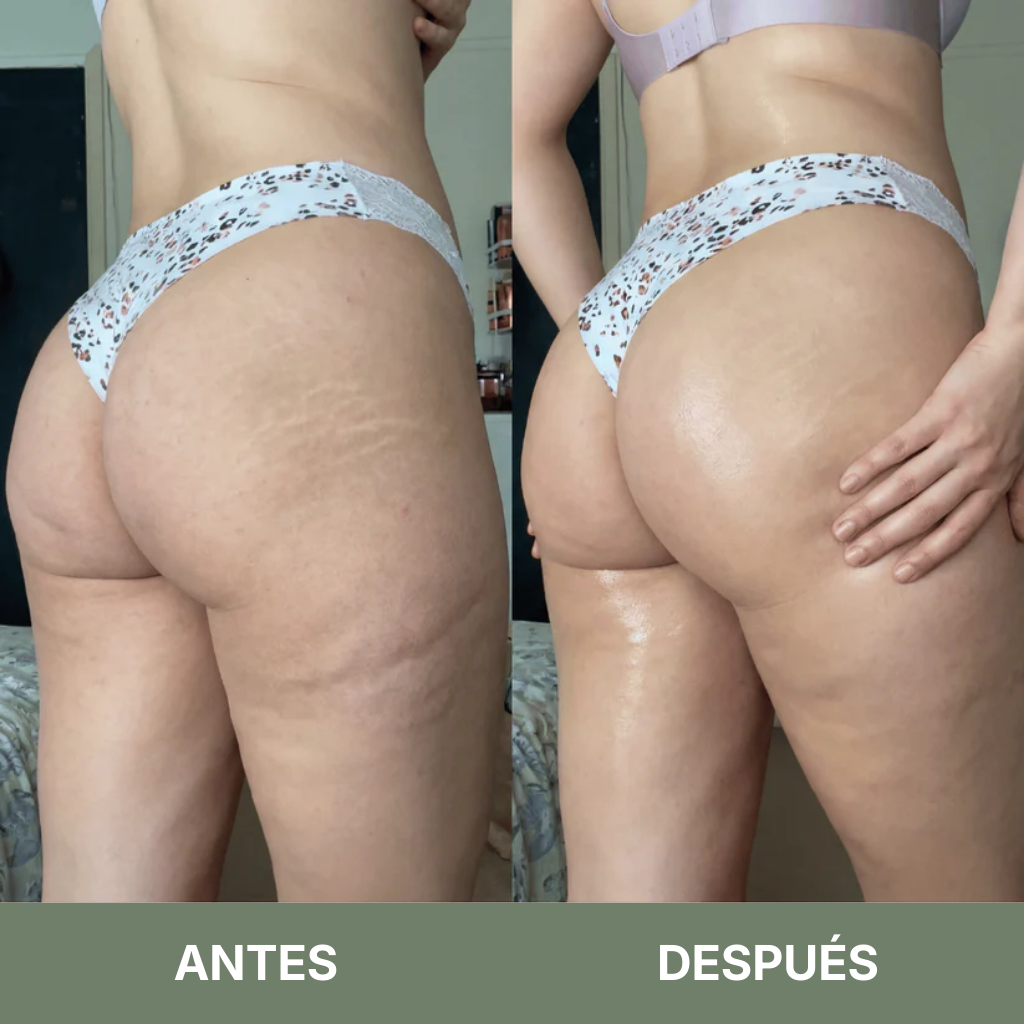 Aceite de Masaje Anticelulitis