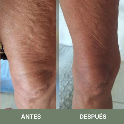 Aceite de Masaje Anticelulitis